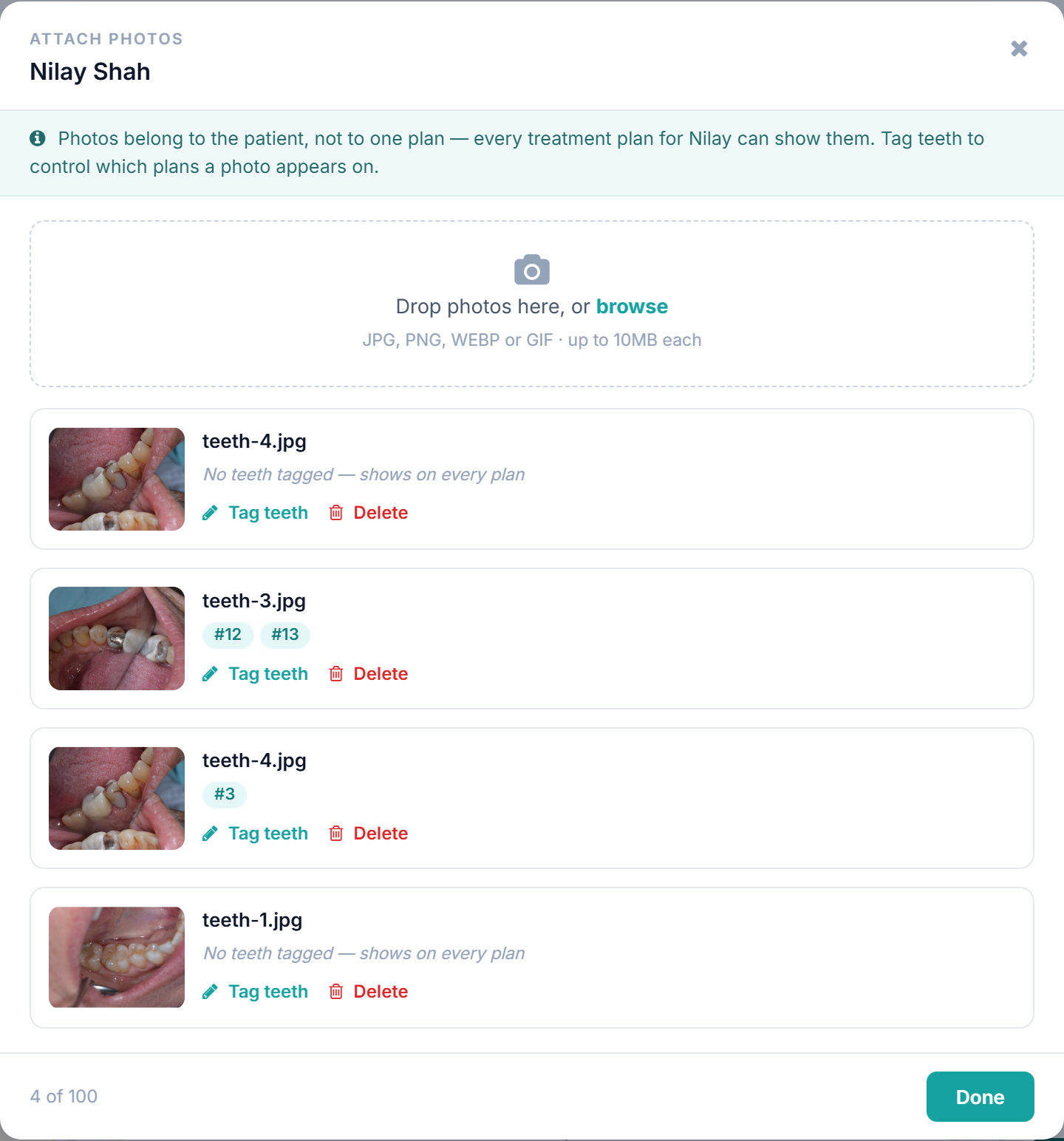 The Attach Photos window listing four photos, each with its teeth tags and Tag teeth / Delete links.