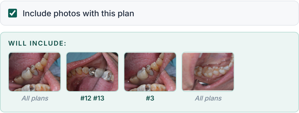 The Send window's photo section with a Will include strip of four thumbnails labelled with their teeth.